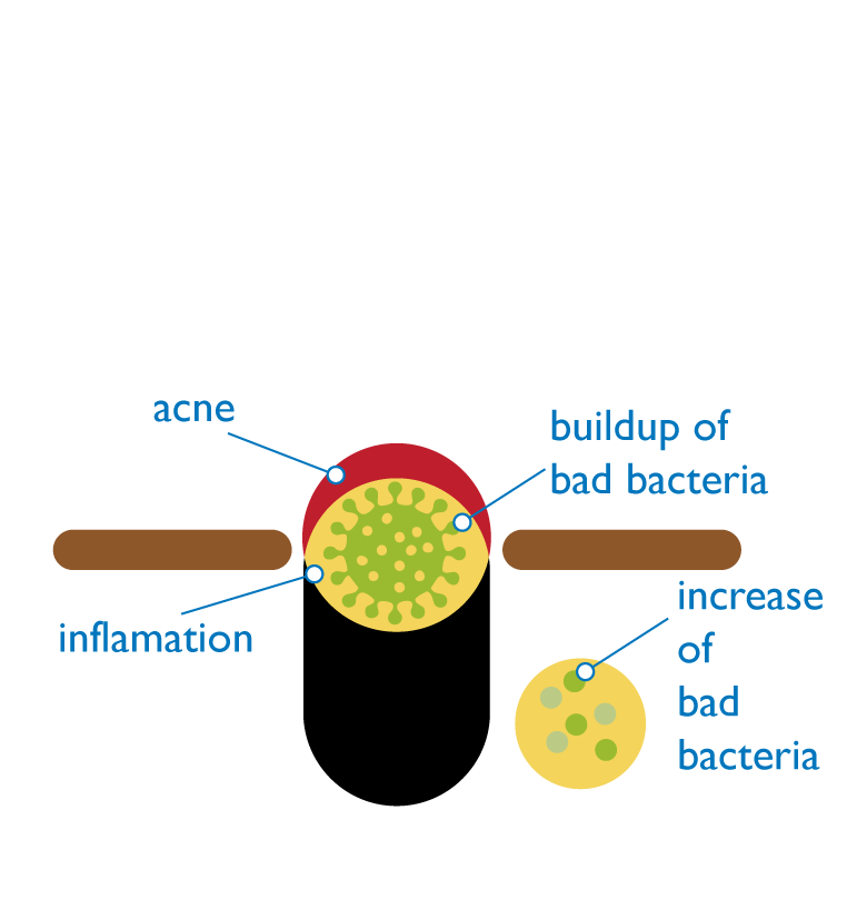Diagram-2